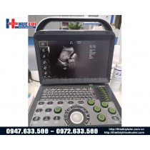 Máy siêu âm doppler màu giá rẻ C50 Máy siêu âm doppler màu giá rẻ C50